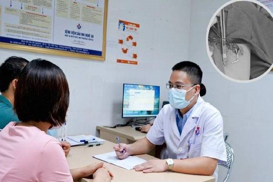 Que tránh thai “đi lạc” cắm sâu vào bắp tay người phụ nữ