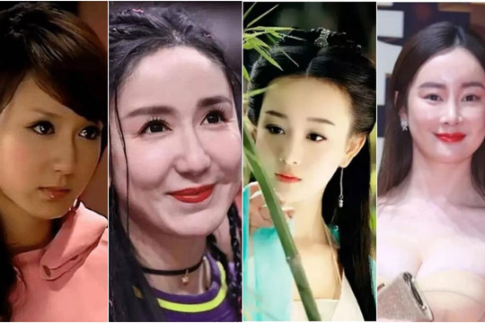 Những mỹ nhân Cbiz này vì phẫu thuật thẩm mỹ mà hủy hoại cuộc đời, con gái có thực sự cần phẫu thuật thẩm mỹ?