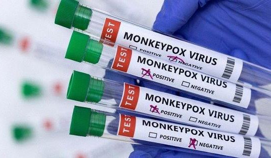 Có nên tiêm vaccine đậu mùa khỉ sau khi Việt Nam đã có ca mắc?