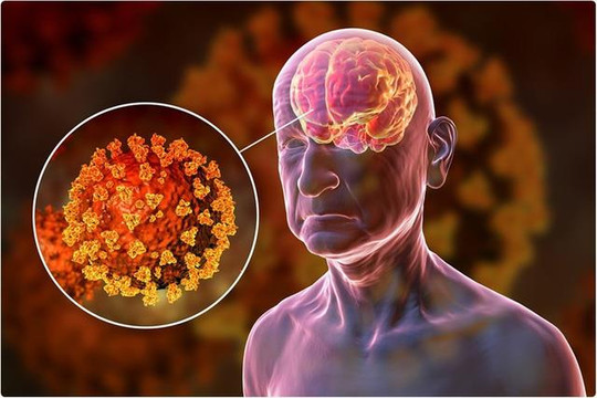 Phản ứng miễn dịch COVID-19 có thể ảnh hưởng đến não, gây ra các triệu chứng thần kinh