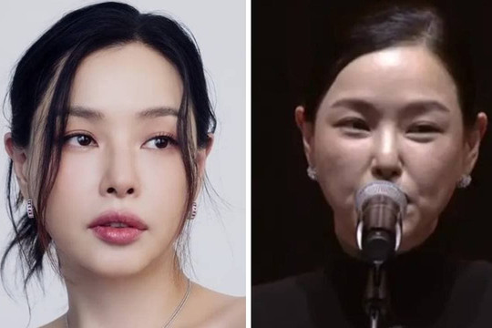 Ảnh đã qua chỉnh sửa và thực tế của 'Hoa hậu đẹp nhất xứ Hàn' có sự chênh lệch đáng ngạc nhiên