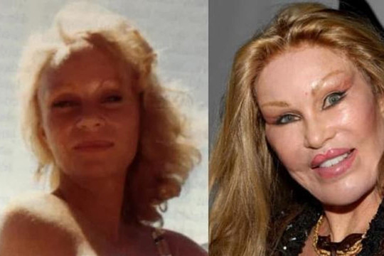 Jocelyn Wildenstein: Đứng đầu trong những ca phẫu thuật thẩm mỹ tốn kém nhất trong lịch sử Hollywood