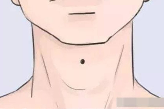 Bốn nốt ruồi phú quý, chỉ chiếm một nốt ruồi thôi là bạn đã đủ giàu rồi!