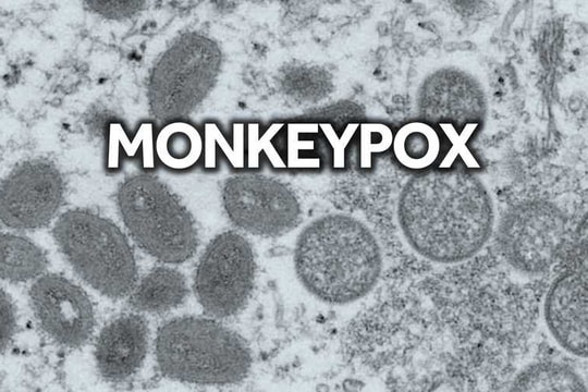 Mỹ cấp phép sử dụng khẩn cấp phương pháp xét nghiệm bệnh đậu mùa khỉ của hãng Roche