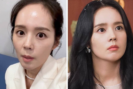 Sau khi bị chê 'xuống sắc không phanh', mỹ nhân 'Mặt trăng ôm mặt trời' đã lột xác như thế nào?