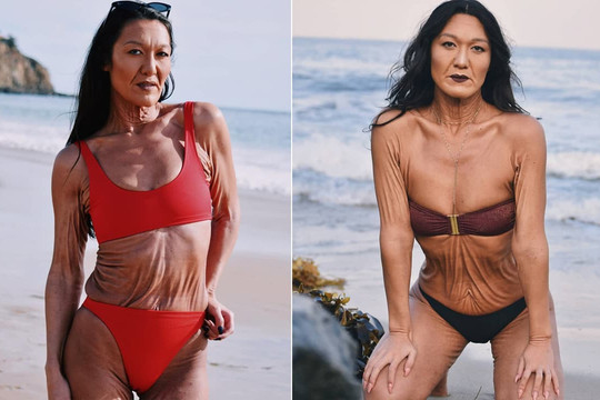 Sara Geurts - người mẫu 31 tuổi mắc chứng da nhăn hiếm gặp và hành trình chấp nhận 'điểm yếu' để tỏa sáng