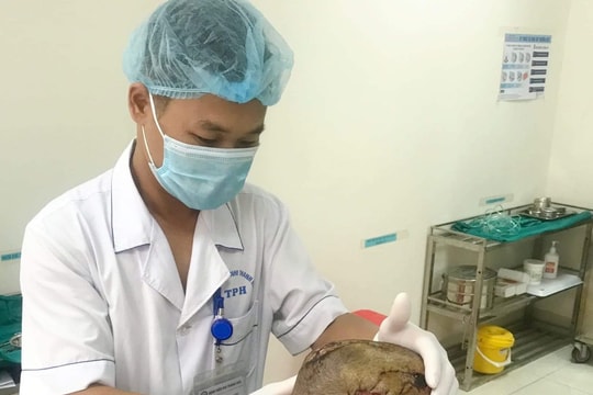 Kịp thời cứu bé trai 34 tháng tuổi bị chó cắn lộ xương sọ