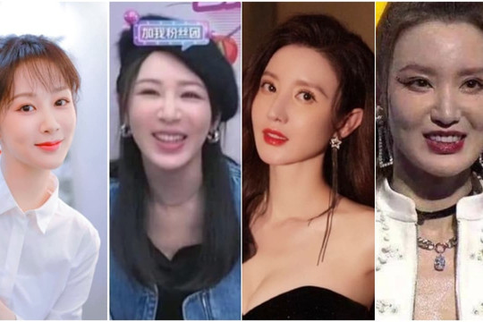Dàn sao nghi vấn phẫu thuật thẩm mỹ: Dương Tử mặt cứng đờ, Mao Hiểu Đồng sưng phù