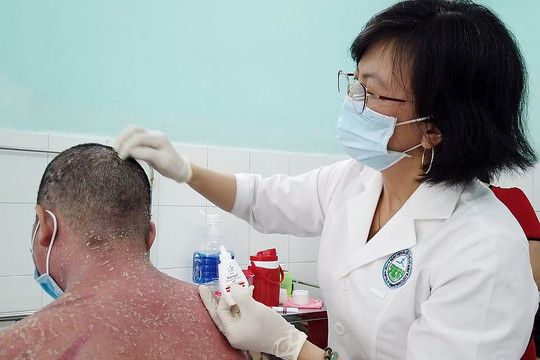 Da bong tróc, biến chứng sau khi dùng thuốc trị vảy nến mua trên mạng