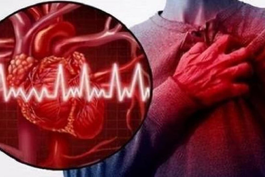 Trong 4 dấu hiệu báo trước cơn đau tim, nướu sưng đau thường dễ bị bỏ qua, bác sĩ hướng dẫn bạn cách tầm soát và phòng ngừa