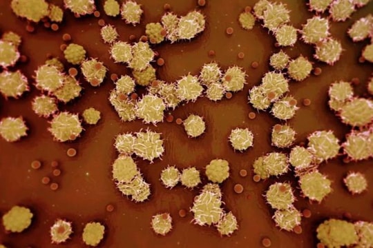 Bệnh đậu mùa khỉ được WHO đặt tên mới là "mpox"
