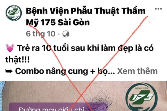 Cảnh báo mạo danh Bệnh viện Quân y 175 để trục lợi