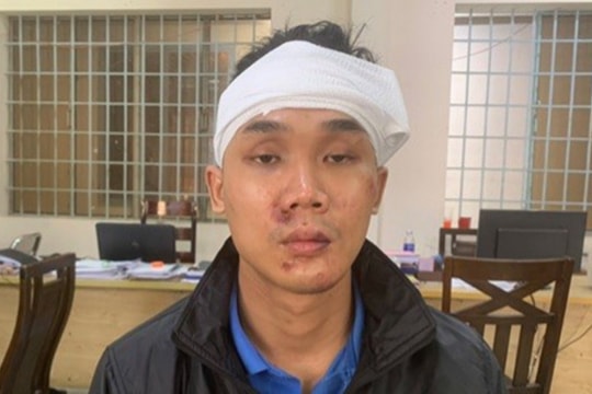 Bắt giam đối tượng đâm Phó Trưởng công an phường trọng thương