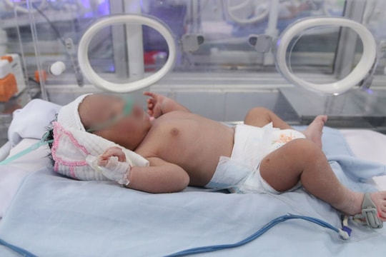 Cứu sống bé sơ sinh dị tật bị bỏ rơi bên đường