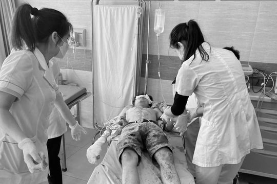 Chấn thương sọ não, nát bàn tay do tự chế pháo chơi Tết