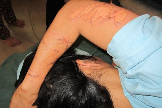 Bi kịch từ mối tình không hôn thú và nỗi đau người ở lại