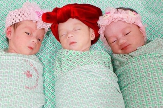 Ca sinh 3 tự nhiên cùng trứng hiếm gặp