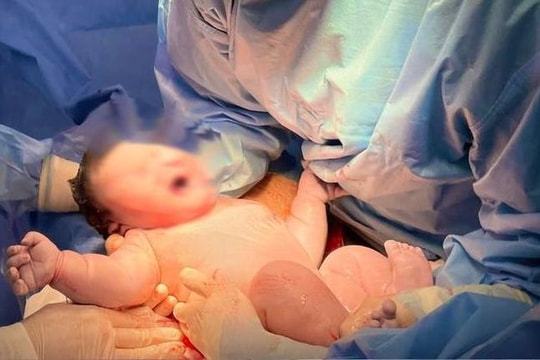 Bé sơ sinh nặng gần 5,8kg, tương đương trẻ 2 tháng tuổi