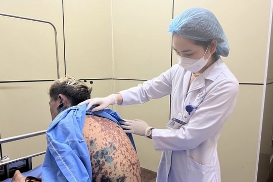 Nhiễm độc nặng sau 2 ngày uống thuốc tự mua