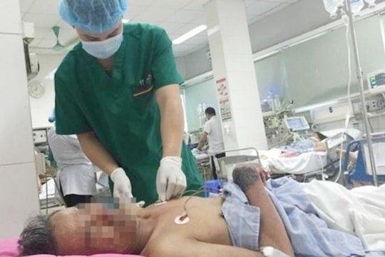 Nguy kịch vì nhiễm liên cầu lợn sau khi giết mổ lợn, ăn tiết canh