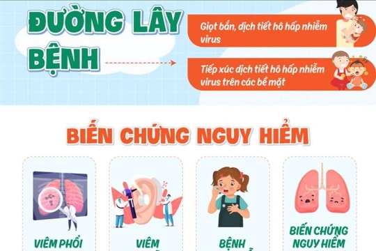 Bác sĩ hướng dẫn cách phòng bệnh virus hợp bào hô hấp (RSV) thời gian giao mùa
