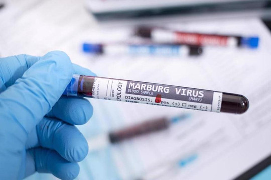 TP.HCM giám sát người nhập cảnh từ châu Phi ngăn virus Marburg