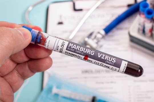 Thái Nguyên: Tăng cường giám sát phòng chống virus Marburg