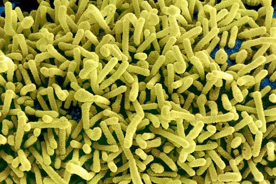 Mỹ cảnh báo nguy cơ virus Marburg lây lan từ châu Phi