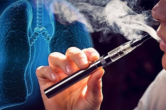 Chiến lược quốc gia về phòng, chống tác hại của thuốc lá