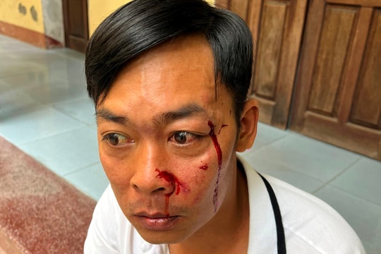 Xác minh vụ việc bị anh họ dùng dao tấn công sau buổi hòa giải