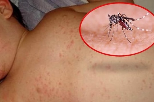 Đắk Lắk ghi nhận ca tử vong do sốt xuất huyết đầu tiên trong năm