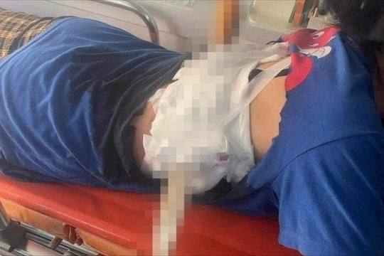 Mâu thuẫn, chồng dùng dao nhọn phóng xuyên lưng vợ