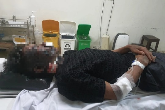 Hai người đàn ông bị sét đánh trúng khi đi bắt cá trong đêm