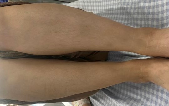 Gặp biến chứng sau 5 năm liền uống thuốc tránh thai