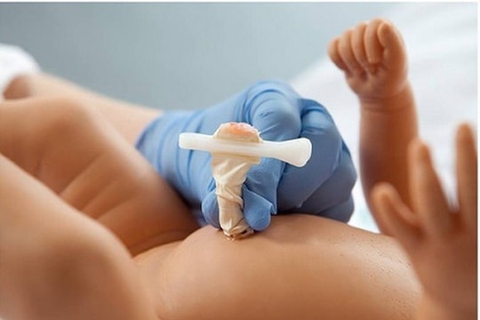 Cắt rốn bằng kéo sinh hoạt, hai trẻ sơ sinh bị uốn ván