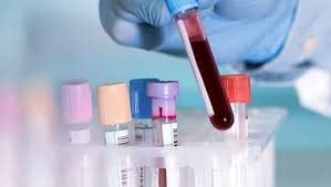 Cục Phòng, chống HIV/AIDS yêu cầu làm rõ nhóm “Bông hồng đen” tự ý lấy máu học sinh
