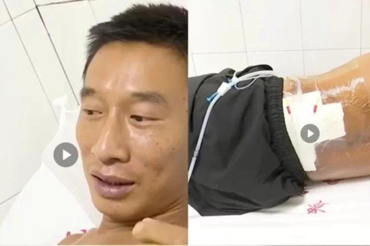 Bị “trời đánh” 2 lần trong 5 phút không chết
