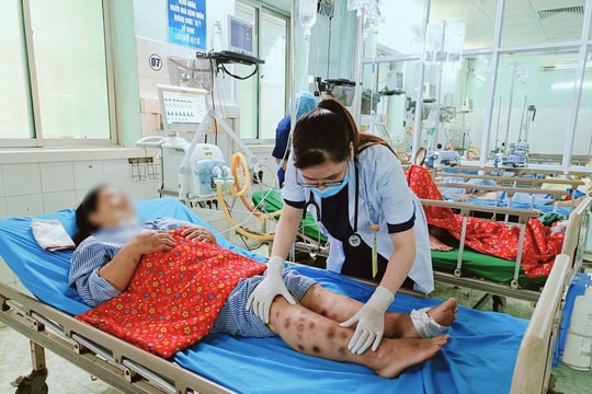 Hoại tử tay chân vì tự tiêm canxi tại nhà