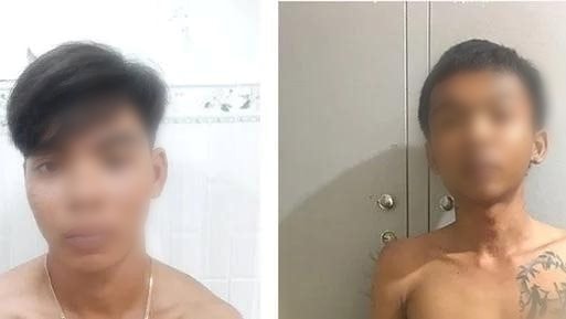 Tạm giữ 3 đối tượng vô cớ chém người sau cuộc nhậu