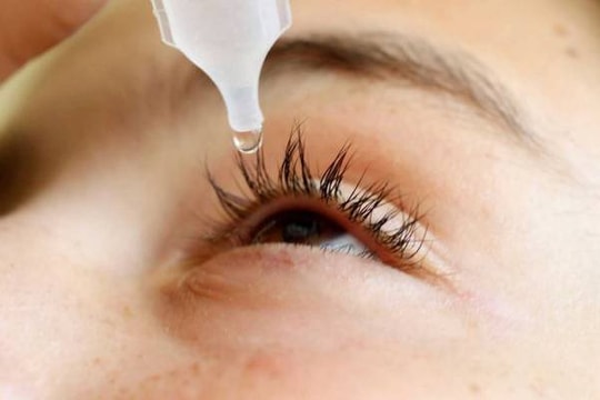 Bệnh đau mắt đỏ lan rộng, cẩn trọng với thuốc chứa corticoid