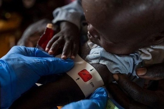Sudan: Hàng nghìn trẻ em chết vì hệ thống y tế sụp đổ