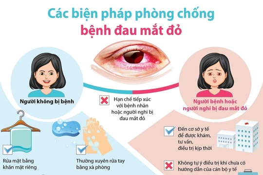 Tăng cường công tác phòng chống bệnh đau mắt đỏ