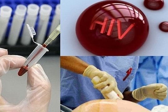 Điều kiện xác định người bị phơi nhiễm, nhiễm HIV do tai nạn rủi ro nghề nghiệp