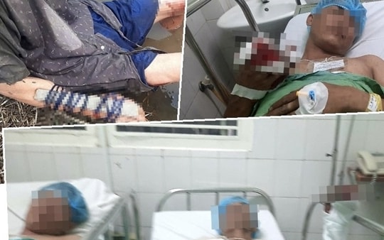 Long An: Mâu thuẫn cho thuê đất ruộng, 4 cha con bị chém trọng thương