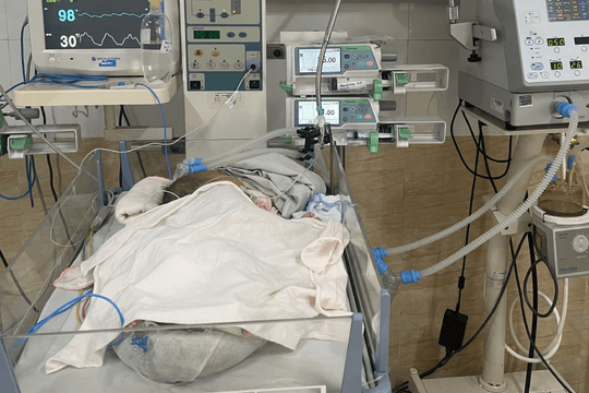Bé trai 1 tháng tuổi ngưng thở do nhiễm virus thường lây qua nụ hôn