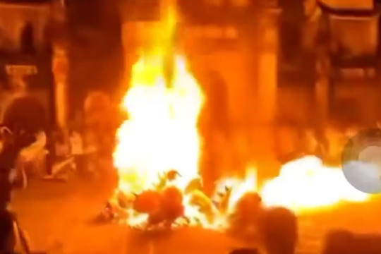 Hà Nội: Sau tiệc vui đêm trung thu, 3 trẻ đốt đầu lân bị bỏng nặng
