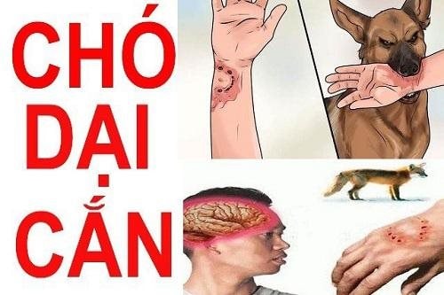 Một trẻ nhỏ tử vong vì bệnh dại do chó nhà cắn