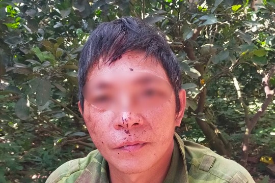 Chồng dùng điếu cày đánh vợ tử vong