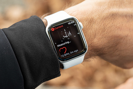 Bổ sung tính năng theo dõi huyết áp trên Apple Watch X