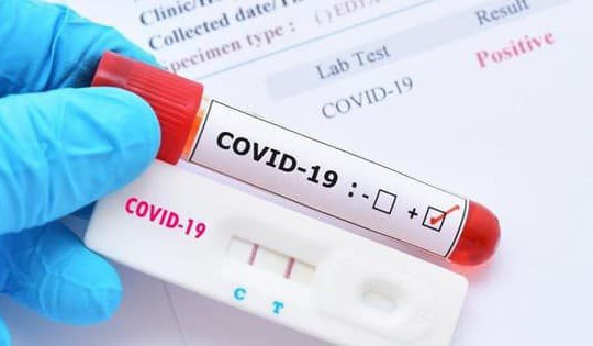 Bị xử lý trong mua sắm phòng chống dịch COVID-19